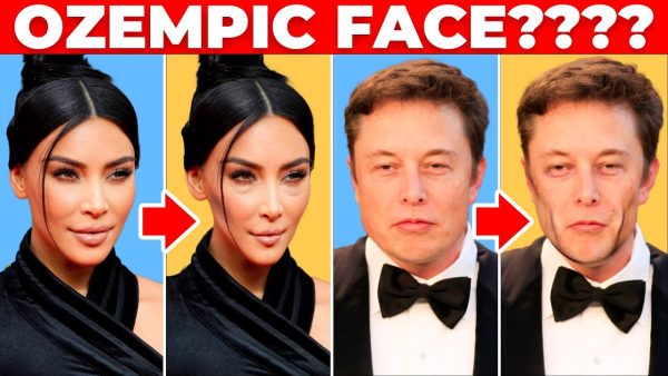 “Ozempik face”: τι συμβαίνει στο πρόσωπο μετά από δραστική απώλεια βάρους και πώς να το προλάβετε?